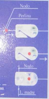 Esquema da Cross Bead